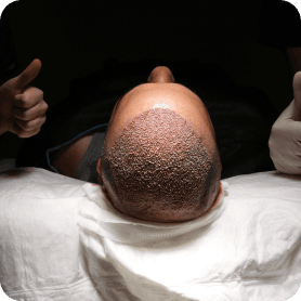 Hair Transplant Clinic